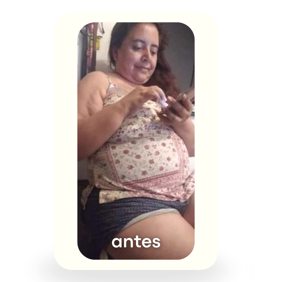 Antes 1