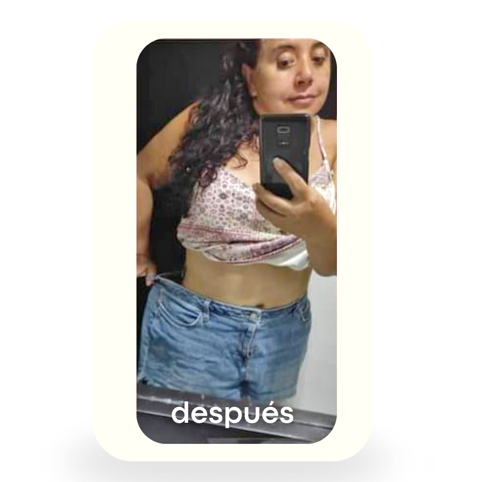Después 1