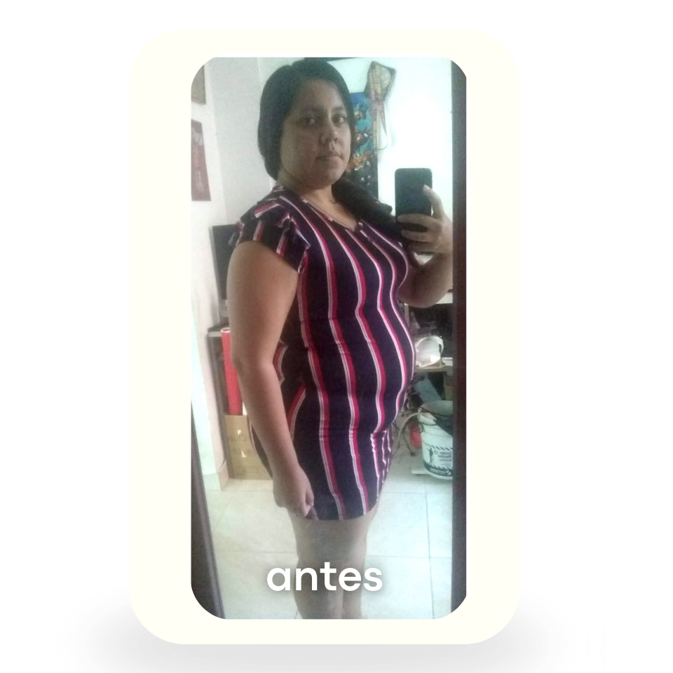 Antes 2