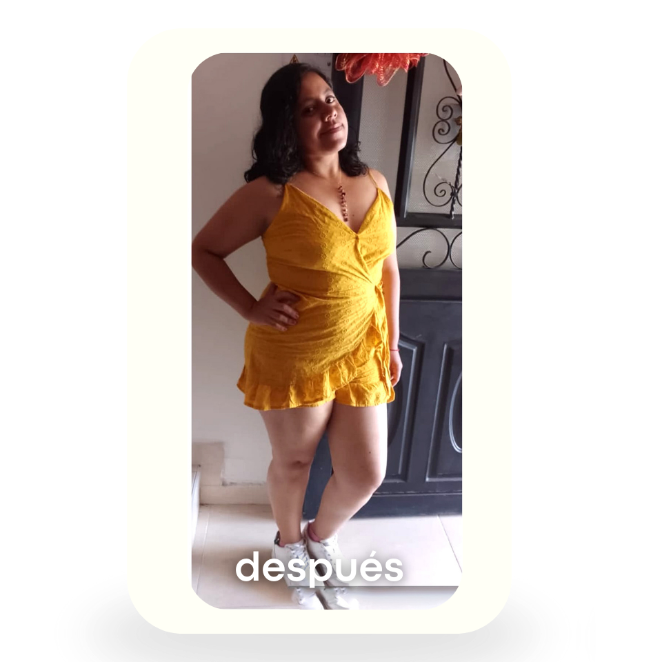 Después 2