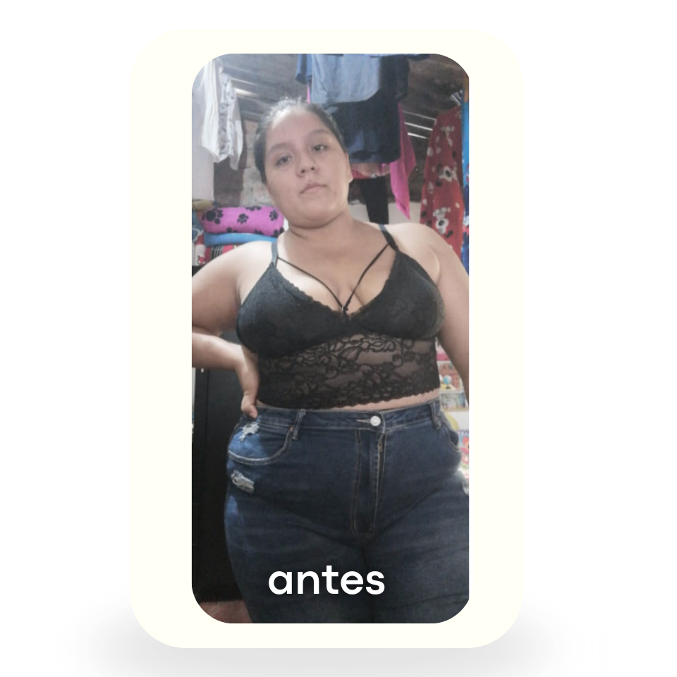 Antes 3