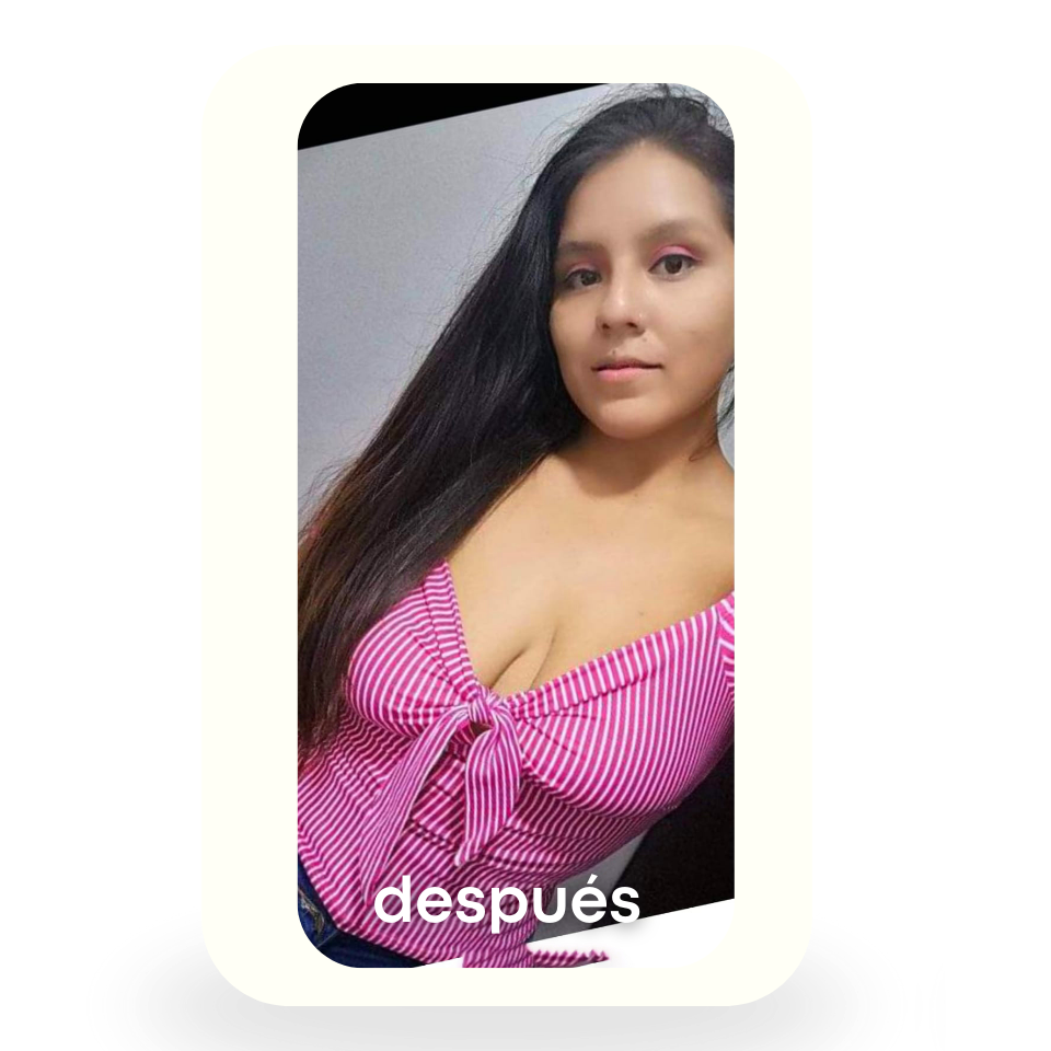 Después 3