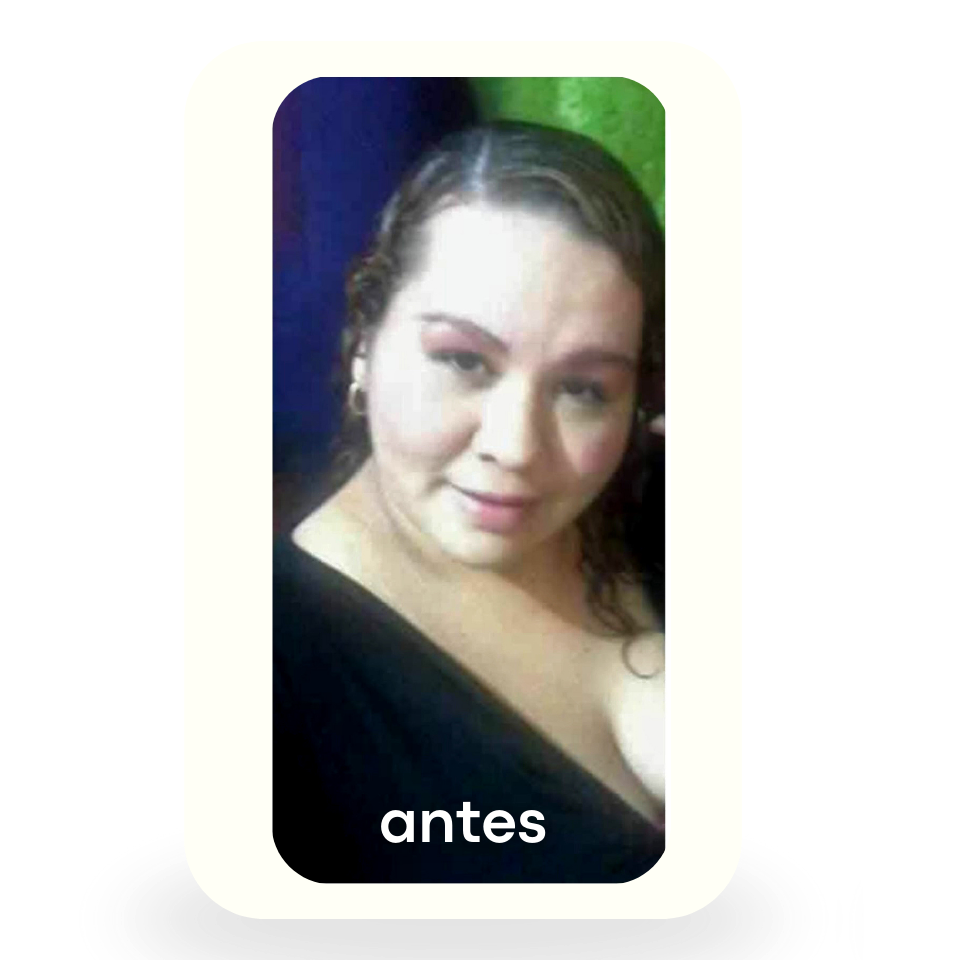 Antes 4
