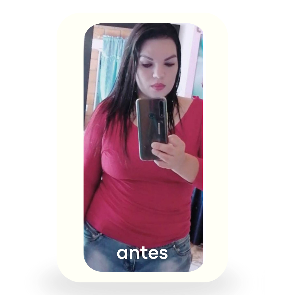 Antes 6