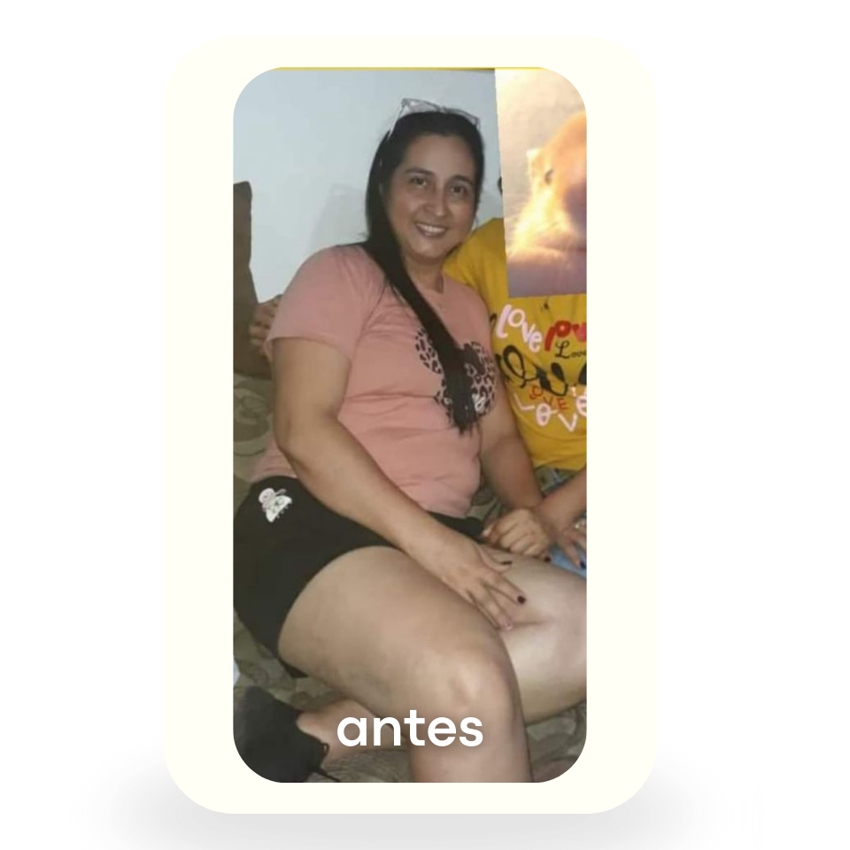 Antes 7